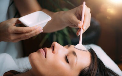 What Is a Chemical Peel?
