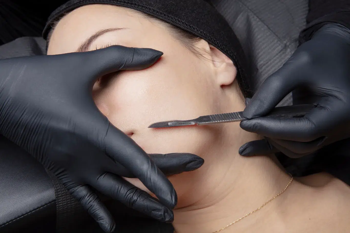 detailed view of a skincare specialist performing a facial exfoliation procedure using a sterile blade